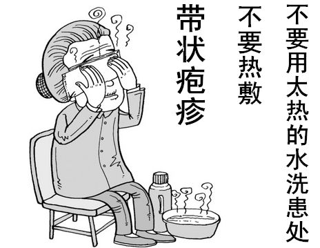 得了带状疱疹需要患者注意哪些?